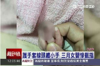 護手套脫線纏指！3月嬰血管壞死截肢