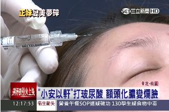 小安以軒打玻尿酸　額頭化膿變爛臉！