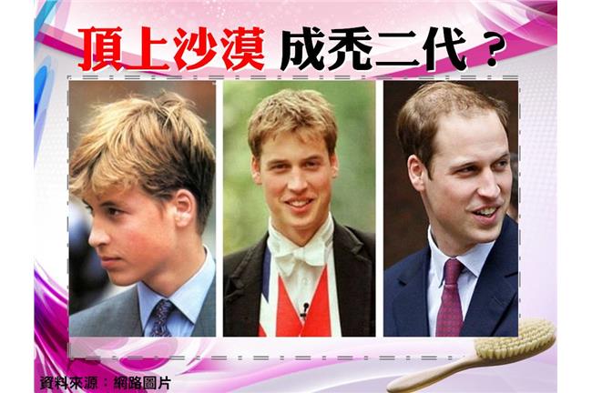 別讓三千絲成為煩惱　落髮迷思報你知