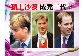 別讓三千絲成為煩惱　落髮迷思報你知