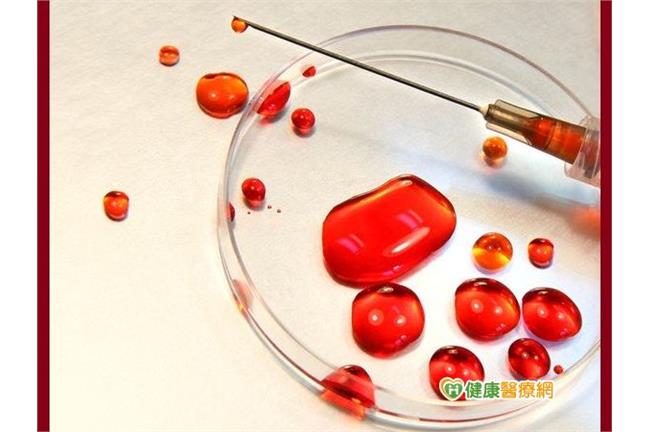 一滴血就可驗癌？專家來解惑