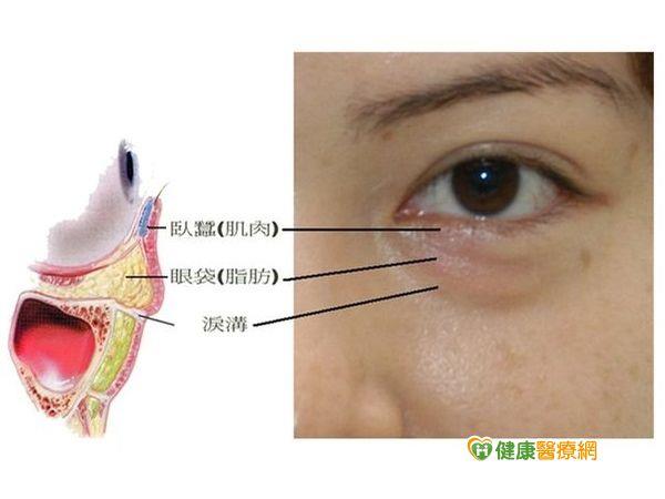 武媚娘眼袋大？醫師表示：熬夜害的