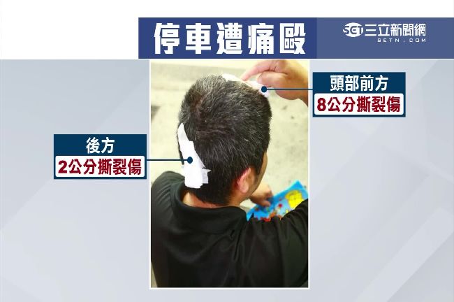 家門前不給停！路邊停車遭惡煞打破頭