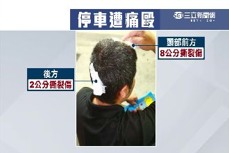 家門前不給停！路邊停車遭惡煞打破頭