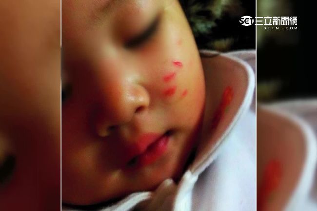 心疼幼女小臉被抓花　母控幼兒園未果