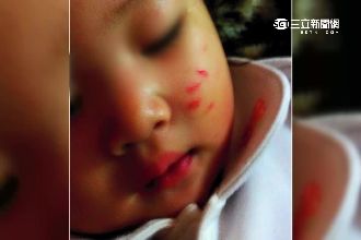 心疼幼女小臉被抓花　母控幼兒園未果