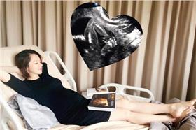 徐若瑄,高齡產婦,V寶,懷孕（臉書）