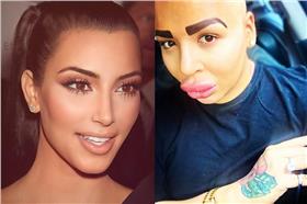 整形成癮誇張厚唇如唐老鴨／Jordan James Parke的instagram(jordanjames2014)