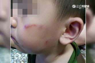 男童嗯嗯來不及拉在地　老師狠甩巴掌