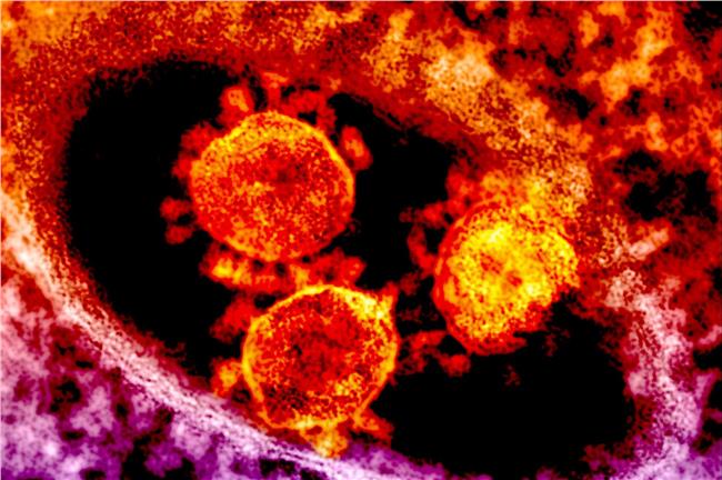 MERS懶人包　5分鐘讓你懂怕什麼