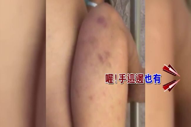 無良看護虐中風癱男　連下體也不放過