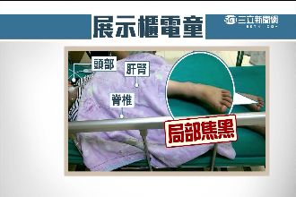 漏電害6歲女恐癱　父怒告百貨公司