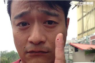 花枝、透抽分不清？林佑星遭花枝咬傷