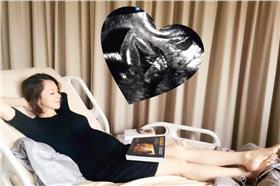 徐若瑄。（圖／翻攝自徐若瑄臉書）