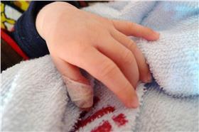 FLICKR/我愛荳芽，蔡/受傷/
https://www.flickr.com/photos/yuyk/4557475406/