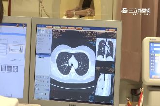 死亡時鐘調快　每年8千人死於肺癌