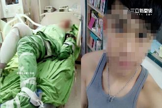 陽光男孩遭火吻　親友心疼臉書集氣！
