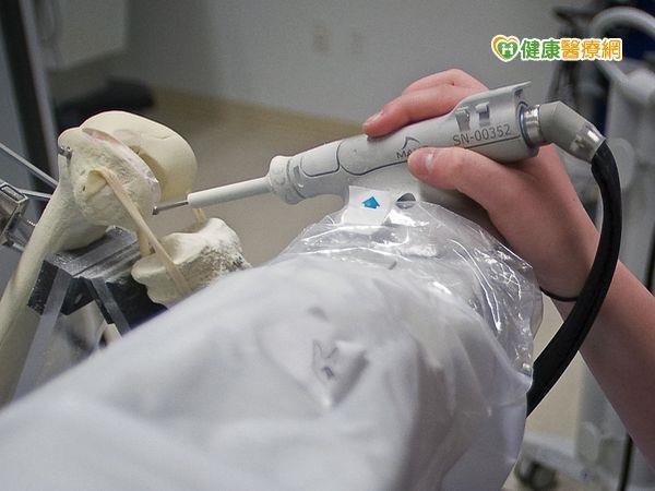 機器人關節手術精準度高！安全性提升