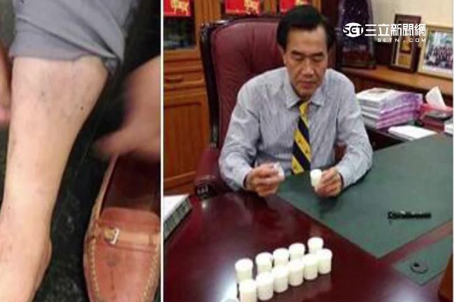 李全教大聊燒燙傷偏方　涉推銷被約談