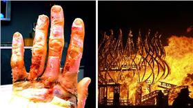 火災.燒傷.燙傷.手指（合成圖／C.C.授權，作者Mindaugas Danys、Chris Bede）