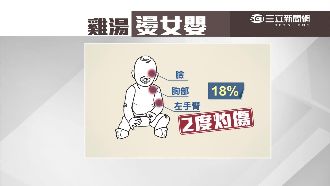 吃鼎泰豐也燙傷　粗心母害雞湯澆女嬰