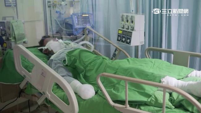 奇蹟男孩呂意銘　看豬腳節目「喊餓」