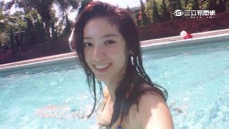 車禍三度灼傷　瑞瑪席丹大方帶疤主持