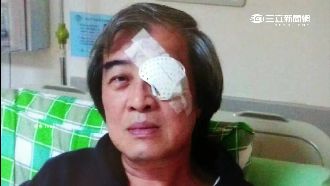 為了千萬保費　商人刺瞎左眼詐保金