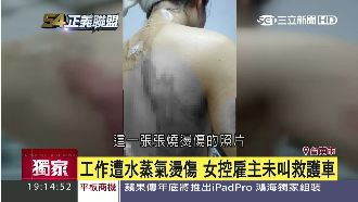 工作被燙傷　懷孕女控雇主沒叫救護車