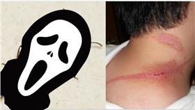 隱翅蟲,毀容,體液,潰爛,蟲▲圖／翻攝自台灣昆蟲維基館