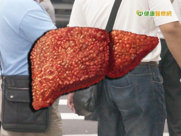 健保肝炎治療缺口　肝臟學會望早日彌