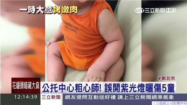 扯！誤開紫光曬傷孩童　托兒所裝沒事