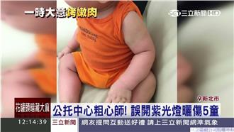 扯！誤開紫光曬傷孩童　托兒所裝沒事