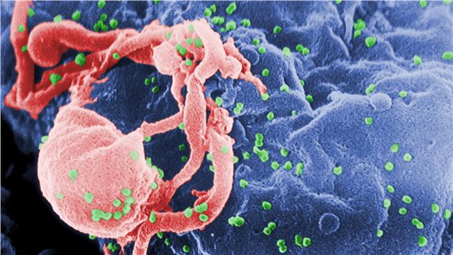 女孩停用藥物　HIV病毒緩解仍過低