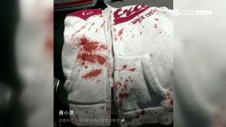 只因像前妻！男朝女子亂吐檳榔汁