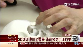 醫美應用3D列印　台人轉往日本整形