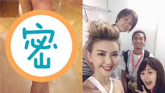 這是女明星的代價！孫燕姿的腿嚇死人
