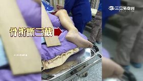 大轉盤斷腳1800