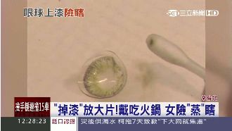 放大片遇熱變形傷角膜　三種情況別戴