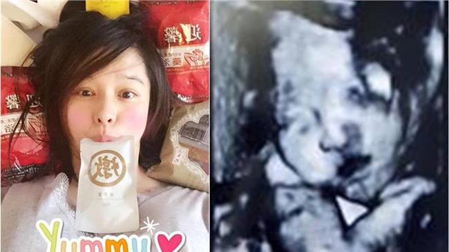 徐若瑄生了！813新加坡生下李V寶