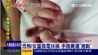1歲女童跌倒　慘遭賣場電扶梯斷指