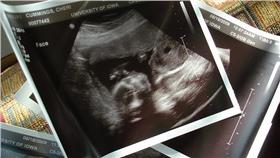 戶籍登記成男　女子超音波證明女兒身 超音波 ▲圖／攝影者Stephen Cummings, flickr CC License https://www.flickr.com/photos/spcummings/3680667494/in/photolist-6Bfodo-4pkpi4-a9tFRg-9knUUj-5QxDtk-6dARit-6unTd5-dJCEnE-dLKSfJ-FtaM6-6tQNXJ-4jpzE2-4ppp3E-6unTe9-6uiHhp-8je6vE-dTwoU-5BYV4f-5XKWd4-dRdnqU-5QxDFz-9iXyyu-cToEsJ-5XH8YF-zdYW5-aF2cZu-aEXmsV-dMcK81-uHCTke-zM2nf-4nUq89-6dEZqs-9Nsn3-6dEZuC-6tQP6A-4y3gXJ-HfSRp-HfSMz-HfPrG-HfPvW-6ARyo1-8U7gnP-HfPs7-6gcsQ2-8aHAYf-8aHAVY-8aEjxz-8aHARA-8aHAPu-8aHALu