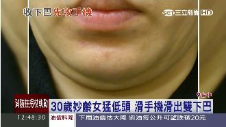 妙齡女慣當低頭族　竟然滑出雙下巴！