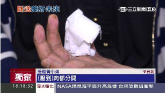 建教實習疑違法派工　生遭機器捲4指