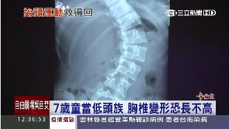 小孩愛低頭要當心　恐胸椎變形長不高
