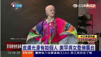 像櫥窗裡的假人！罕病女成另類模特兒