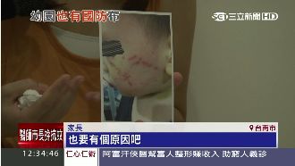 小孩自抓臉破相？園方推託家長氣炸！