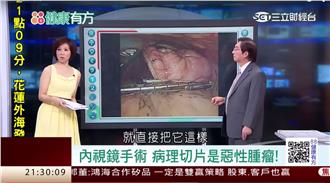 擊敗肺腺癌！從胸腔內外科雙管齊下