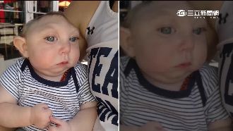 醫生說「活不久」　無腦兒奇蹟慶週歲