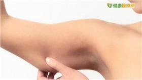 蝴蝶袖粗手臂困擾　超音波抽脂能改善／健康醫療網